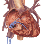 心律不整與電氣生理燒灼術(相關圖片)