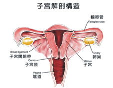 子宮肌瘤治療之新趨勢(相關圖片)