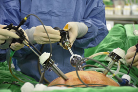 微創肝臟手術新進展 (相關圖片)