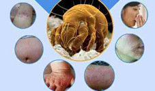 甩開過敏保健康(相關圖片)