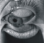 國家生技醫療品質掛保證   缺油！缺水！正確診斷、安全有效治療乾眼症(相關圖片)