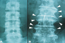 男人腰痠背痛的原因  竟是下背痛(相關圖片)