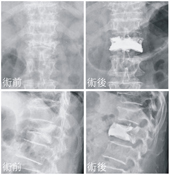 男人腰痠背痛的原因  竟是下背痛(相關圖片)