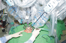 達文西機器手臂是頸部腫瘤切除手術利器(相關圖片)