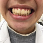 有口難言   食不下嚥-頭頸部癌症患者的嗓音及吞嚥復健(相關圖片)