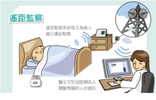 植入式心律去顫器偵測   無症狀心肌缺氧(相關圖片)