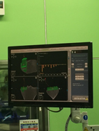「膝」福音  引進機器人置換關節重建術(相關圖片)