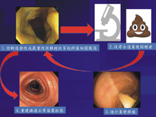 神奇的糞便  談糞便移植(相關圖片)