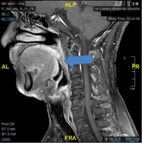 小心!打鼾竟然可能隱藏著猝死的風險   談打鼾合併睡眠呼吸中止症(相關圖片)
