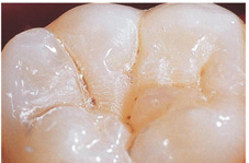 兒童牙齒保健莫輕忽 應從小做起(相關圖片)