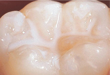 兒童牙齒保健莫輕忽 應從小做起(相關圖片)