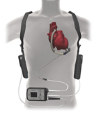 心臟衰竭病患曙光    心室輔助器(相關圖片)