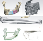電腦輔助系統讓正顎手術、植牙和顏面部重建更快更準(相關圖片)