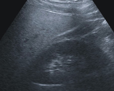 春節前後聚餐多 消化健康如何顧得好(相關圖片)