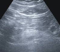 春節前後聚餐多 消化健康如何顧得好(相關圖片)