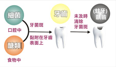 兒童牙齒顧得好 口腔保健不能少牙(相關圖片)