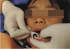 兒童牙齒顧得好 口腔保健不能少牙(相關圖片)