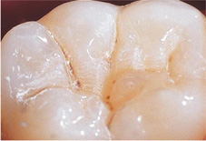 兒童牙齒顧得好 口腔保健不能少牙(相關圖片)