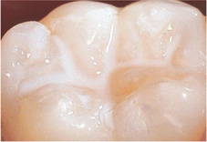 兒童牙齒顧得好 口腔保健不能少牙(相關圖片)