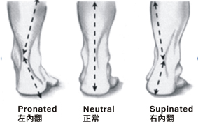 腳不對，整個身體都不對  談兒童下肢發展與扁平足(相關圖片)