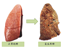 小心「菜瓜布肺」(相關圖片)