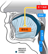 睡眠呼吸中止症  四十年的治療發展及未來的契機(相關圖片)