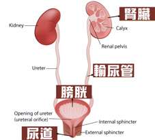 尿路結石的3大迷思及預防5大原則(相關圖片)