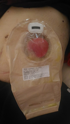 『嗯嗯』  這裡排人生仍精彩(相關圖片)