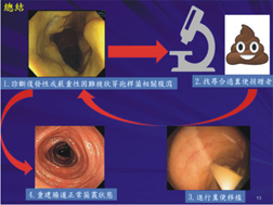 不是『腦不行』,是『腸失靈』?『糞便值千金︰微菌叢移植挽回腸道健康及認知功能』(相關圖片)