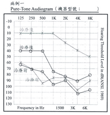 傷口的救星 『高壓氧』治療 (相關圖片)