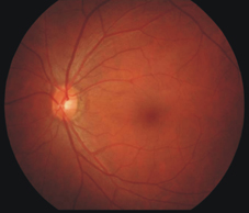 傷口的救星 『高壓氧』治療 (相關圖片)