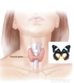 別疏忽! 你不可不知的甲狀腺結節(相關圖片)