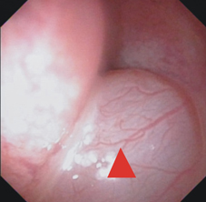 頭頸外科裡的GPS      指引手術不迷航(相關圖片)