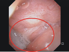 頭頸外科裡的GPS      指引手術不迷航(相關圖片)