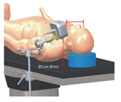 頭頸外科裡的GPS      指引手術不迷航(相關圖片)