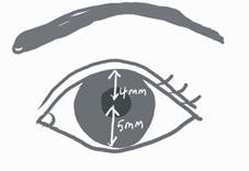 換回『炯炯有神』 談老年人的『眼瞼下垂」(相關圖片)