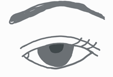 換回『炯炯有神』 談老年人的『眼瞼下垂」(相關圖片)