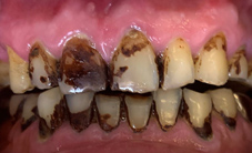 皮膚要美白  你知道牙齒也可以美白嗎?(相關圖片)