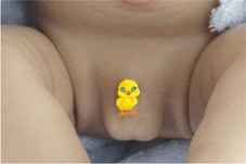 蛋蛋不見了?   談『伸縮性睪丸』(相關圖片)