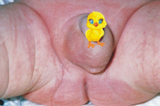 蛋蛋不見了?   談『伸縮性睪丸』(相關圖片)