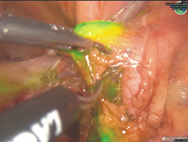 精準醫療科技  婦科疾病的蛻變及創新(相關圖片)