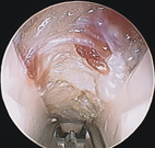 手麻手痛   解救『腕隧道症候』(相關圖片)