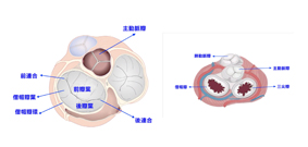 退化性僧帽瓣逆流及修復手術(相關圖片)