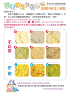 不可忽視的嬰兒灰白便  談『膽道閉鎖』(相關圖片)