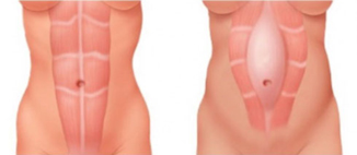 亞東形美 開賣六塊肌(相關圖片)