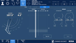 精準醫療  機器手臂輔助人工關節置換(相關圖片)