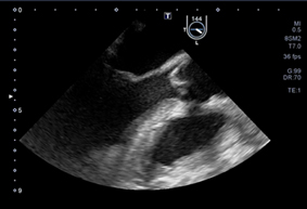 經食道超音波導引CPR  高準確性與高精準CPR (相關圖片)
