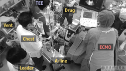 經食道超音波導引CPR  高準確性與高精準CPR (相關圖片)