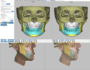 電腦影像模擬合併導航系統    有效提高手術效率和精確度(相關圖片)