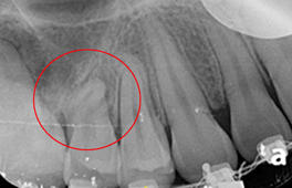 電腦影像模擬合併導航系統    有效提高手術效率和精確度(相關圖片)
